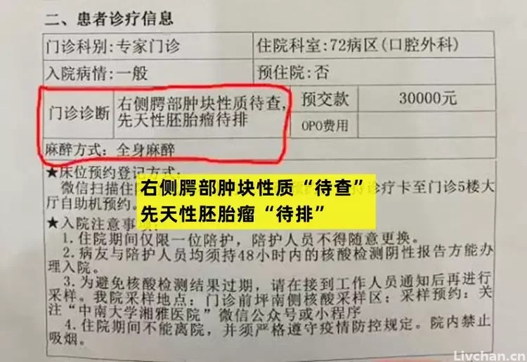 湘雅40年资历名医把莲子壳看成肿瘤？张煜医生揭秘内幕