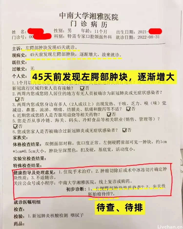 湘雅40年资历名医把莲子壳看成肿瘤？张煜医生揭秘内幕