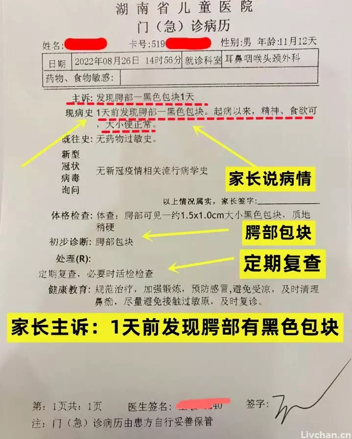 湘雅40年资历名医把莲子壳看成肿瘤？张煜医生揭秘内幕