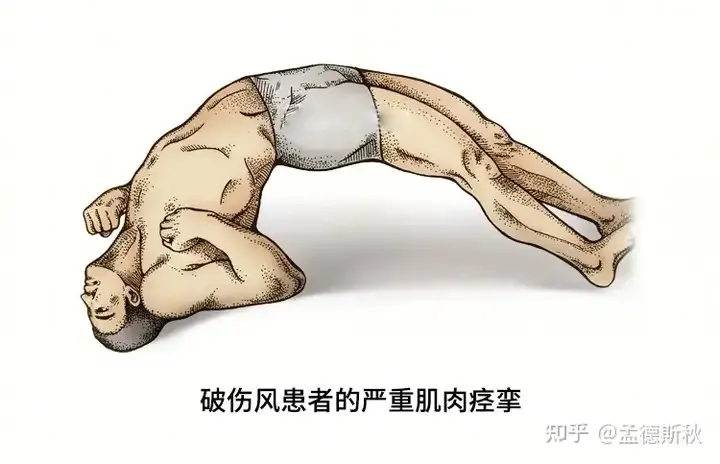 古代白绫赐死痛苦吗？